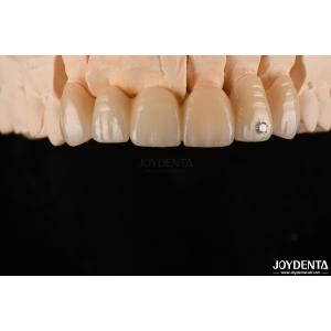 Cheap CAD / CAM Milling Dental Layered Zirconia For Single Crowns 0.3-0.5mm Layer Thickness for sale