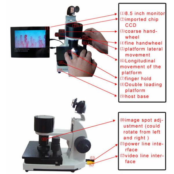 High Accuracy Nail Folding Microcirculation Microscope with High Definition