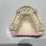 Removable Cast Clear Framework Partial Easy To Clean And Take Off