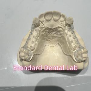 Cheap Removable Cast Clear Framework Partial Easy To Clean And Take Off for sale