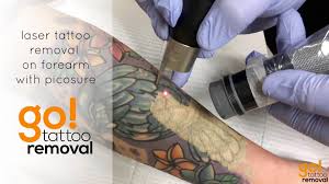 Double Rods Handpiece Q swtich Nd Yag 532nm Professional Laser Tattoo Removal Machine