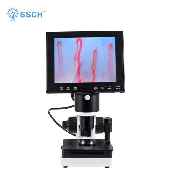 Quality Portable Nailfold Capillary Diagnosis Microcirculation Microscope Blood Circulation wholesale