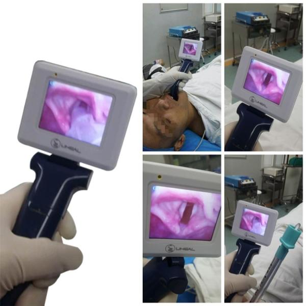 Quality Operating Portable Video Laryngoscope Using In Routine Endotracheal Intubation wholesale