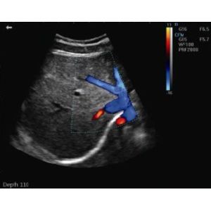 Portable Pregnancy Ultrasound Scanner with Abdominal Convex Transvaginal