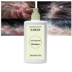 GMPC Private Label Clarifying Shampoo ODM Oil Control Anti Dandruff Anti Itchin