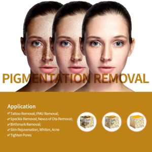 Ce Portable Q Switched Nd Yag Laser Tattoo Removal Machine