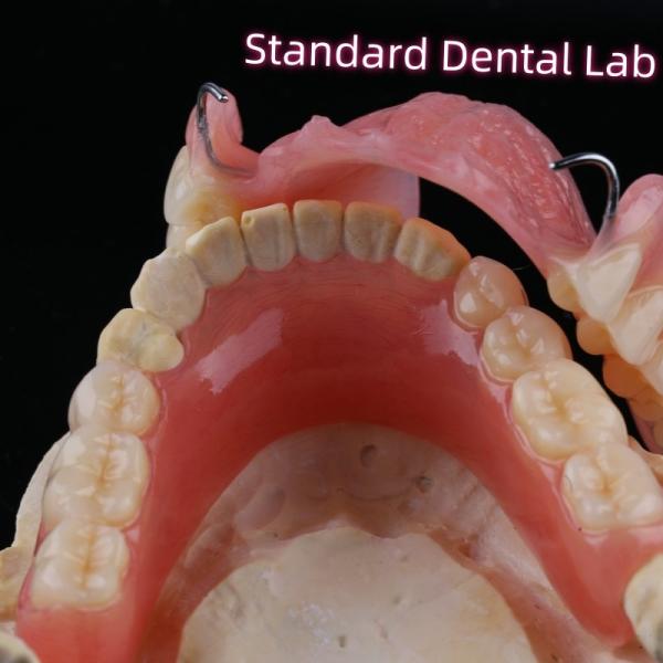 Quality Removable Dental Restorations Acrylic Partial Denture Teeth With Wire Clasps wholesale