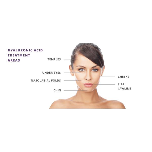 2ml Cross Linked Medical Sodium Hyaluronate Gel Facial Filler Injection