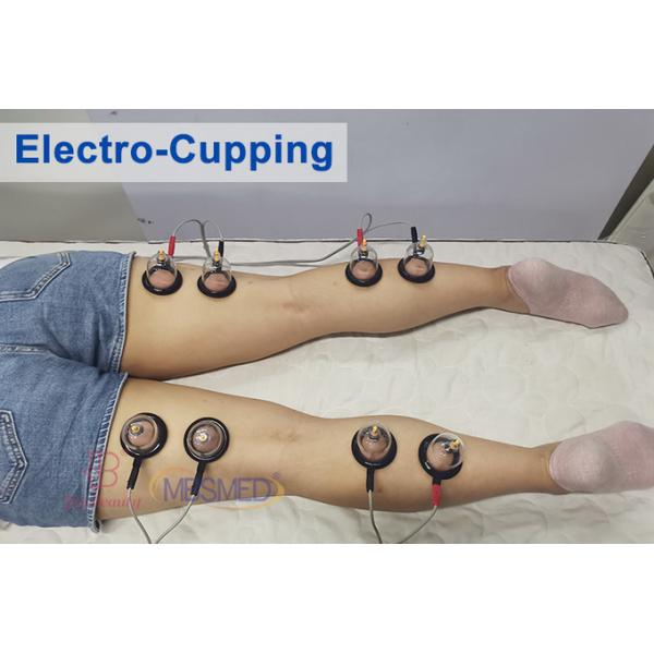 Tens Electrotherapy Microcurrent Russian Waves Muscle Stimulation Cupping Therapy Massager
