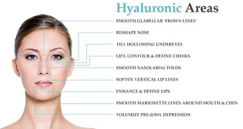 Korea Injection Lidocaine Hyaluronic Acid Wrinkle Fillers For Deep Wrinkles 2ml