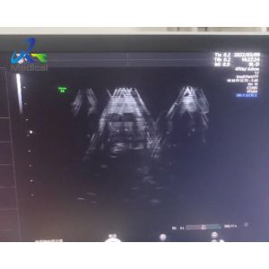 China GE Voluson E8 Ultrasound Machine Repair Abnormal Ultrasound Images Replace Rfm Board on sale