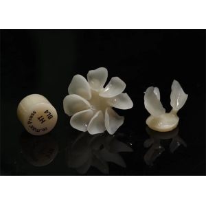 Durablity CAD-CAM Dental Composite Veneers Highly Detailed Accurate