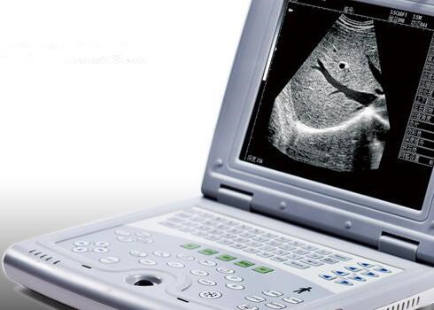 Portable Ultrasound Machine for Pregnancy Portable Ultrasound Scanner Only 2