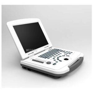 80 elements Ultrasound Scanner Laptop Ultrasound Scanner B580 with Battery