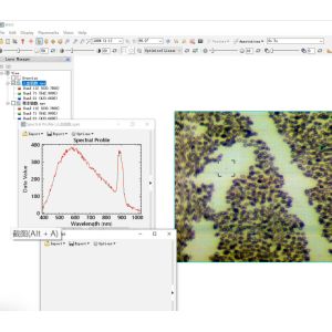 Hyperspectral Microscope Imaging System For Gastric Cancer Detection