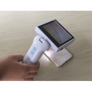 10X Magnification Ophthalmology Equipment