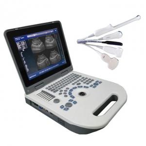 Cheap CE USG Laptop Black And White Ultrasound Machine mobile SVGA Video Output for sale