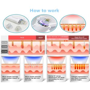 Cheap 15&quot; TFT LCD Size Diode Laser Hair Removal Machine for Quick and Painless Treatment for sale