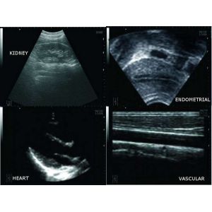 5G Wifi Handheld Ultrasound Scanner Pocket Ultrasound Built - in 4200mAh Lithium