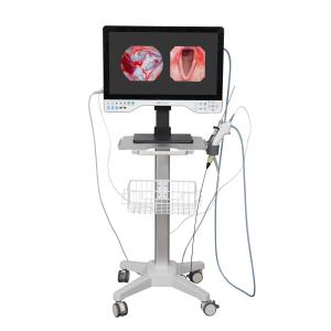 FHD All In One Endoscope Camera System Built-in LED Light & Flexible Scope For Laparoscopy