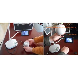 Safe Light Source No Laser Vein Locator Device With High Resolution