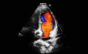 Ultrasound Tranducer Handheld Ultrasound Scanner Compatible To Windows / Android