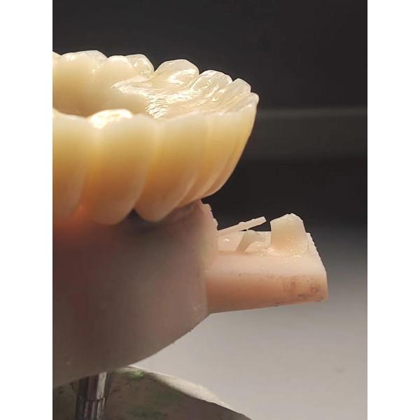 1200 Mpa Dental High Translucency Multilayer Zirconia Block A2 98*20mm CAD CAM