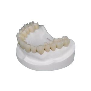 China Durable Zirconium Dioxide Crown No Odor No Corrosion No Irritation To Pulp Nerves on sale