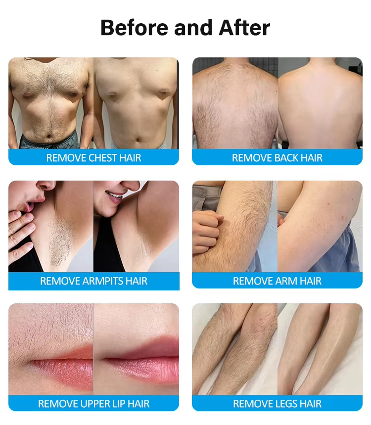 High Power 3000W 4 Waves Diode Laser Permanent Professional Hair Removal 808 Diode Laser Painless Epilator Lazer Machine