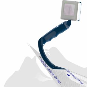 China Curved Blade Laryngoscope Macintosh And Miller Laryngoscope Types on sale