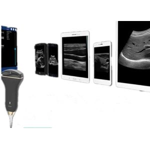 USB Ultrasound Probe Handheld Doppler Machine Supported Windows Android