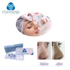 Fosyderm Hyafilia 2ml Lip Filler Hyaluronic Acid Gel Injection