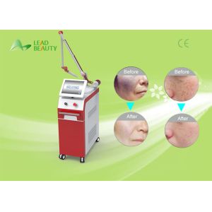 Factory direct sale!!!q-switch nd yag laser tattoo removal machine for sale