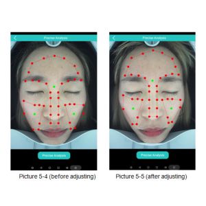 Professional Facial Skin Analysis Machine With Sharing Could Storage