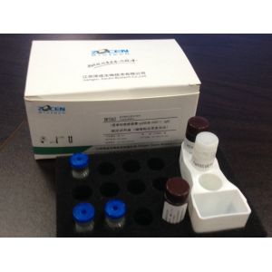 Virus diagnostic test Calprotectin for Closed Automatic immunoassay analyzer in