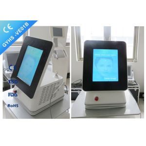 China CE Passed Portable Laser Spider Vein Removal Machine 980nm Varicose Veins Removal on sale