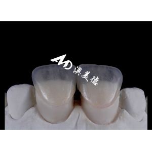 Transform Your Smile with IPS emax Press Porcelain Veneers Strength Aesthetics