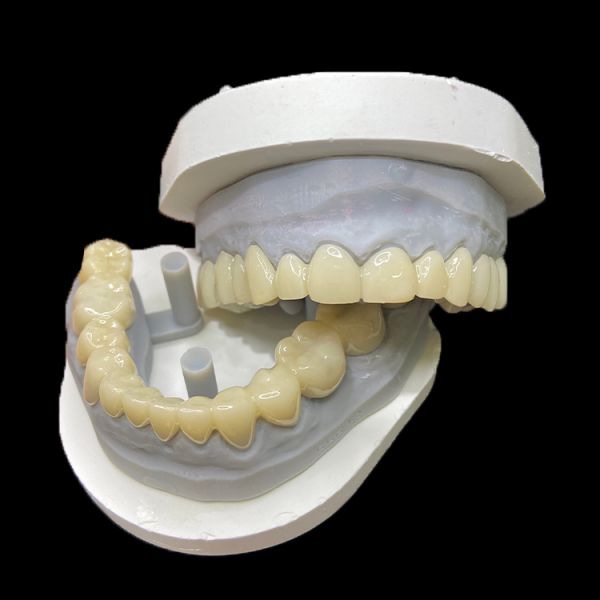 PMMA Temporary Restorations CAD/CAM PMMA Crowns and Bridges for Provisional