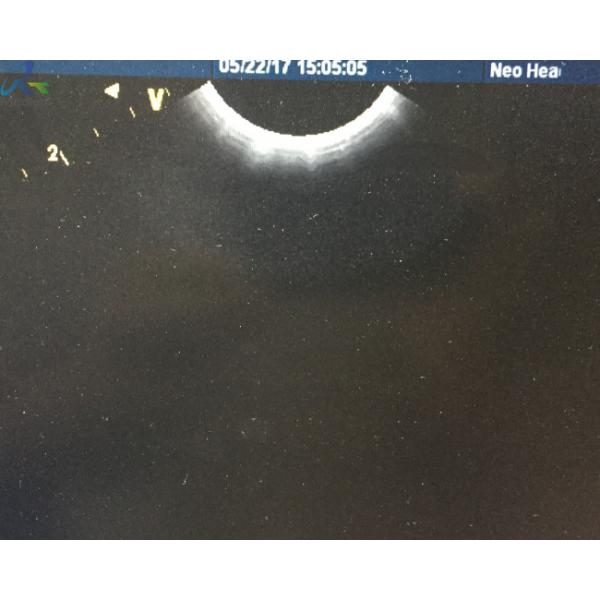 Quality GE 8C-RS Micro Convex Ultrasound Transducer Probe Medical Devices Small Parts wholesale