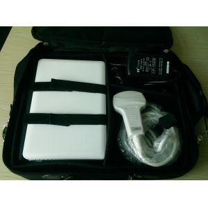 Transvaginal Handheld Ultrasound Scanner With 5 Kinds Of Probe Heads Exchangeabl