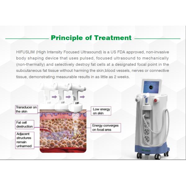 HIFU SLIM PRINCIPLE.png