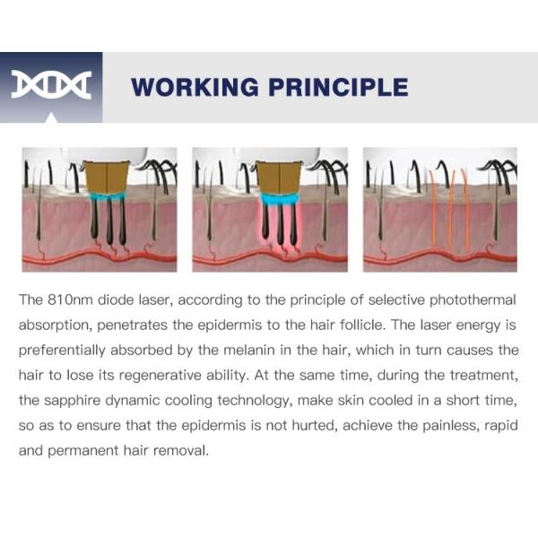 2022 New high power fixed 810nm diode to high quality laser rapid hair removal machine