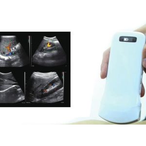 Home Doppler Ultrasound Portable Diagnostic Hand held Doppler Ultrasound