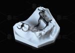 High Strength 3D Printed Titanium Framework With Clear Clasps For Durable