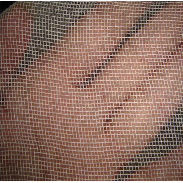 Hospital Sterile Medical Gauze Swab Soft Absorbent 4x4 X-Ray Detectable