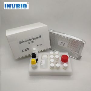 Medical MSDS Kit Test Elisa Rapid Diagnostic T3 T4 HIV HBsAg CA PSA AFP