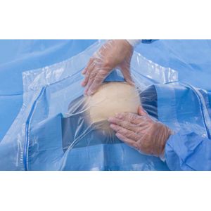 Nonwoven Fabric Disposable Surgical Drapes Non Reinforced ISO13485
