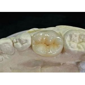 Translucent Natural Looking Zirconia dental Crown with Excellent Durability and