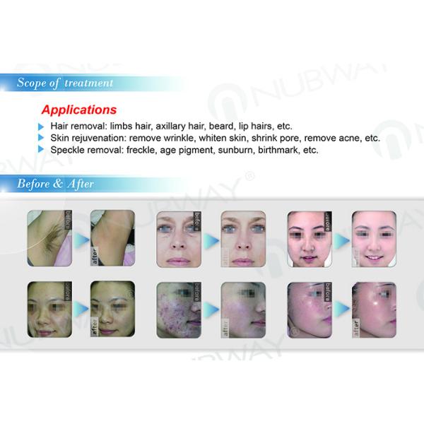 2018 Newest professional SHR IPL hair removal machine Nubway China