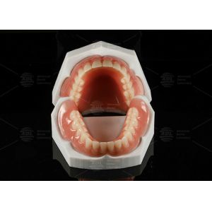 High Esthetics Removable Full Acrylic Denture Acrylic Complete Denture